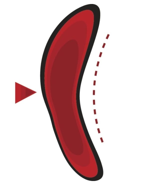 BOTIN DIELECTRICO PROTON EH